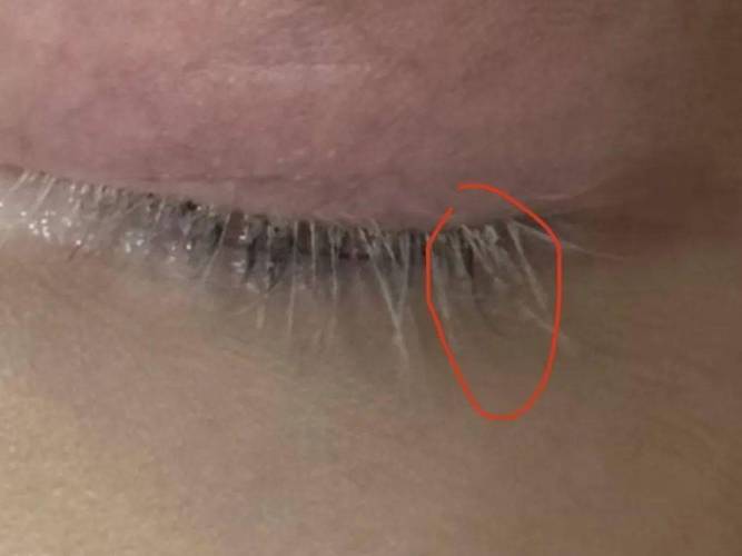 眼皮上长了根白毛算命 右腮长了一根白毛命理
